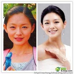 整容女明星网红是谁,美丽背后的故事