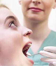 明星网红拔智齿图片高清,高清图片揭秘口腔美容新潮流