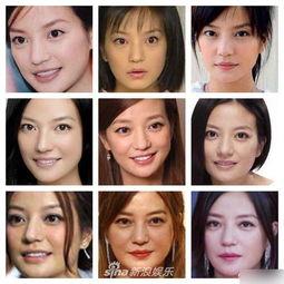 明星网红拔罐图片高清,揭秘高清图中的健康奥秘