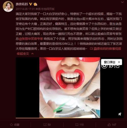 明星网红如何美白牙齿,明星网红美白牙齿秘籍大公开
