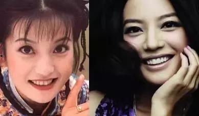 明星网红如何美白牙齿,明星网红美白牙齿秘籍大公开